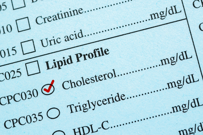 A closeup of a lipid profile with the cholesterol box checked